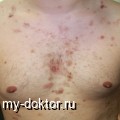 . . . .  - MY-DOKTOR.RU