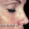    - MY-DOKTOR.RU