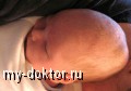 Синдромы, сопровождающиеся утечкой воздуха у новорожденных - MY-DOKTOR.RU