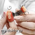 Съемное зубное протезирование - MY-DOKTOR.RU