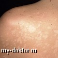      ? - MY-DOKTOR.RU