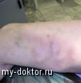      - MY-DOKTOR.RU