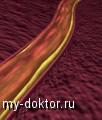 Тромбоз брыжеечных сосудов. Венозный и артериальный тромбоз - MY-DOKTOR.RU