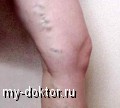   . , ,  - MY-DOKTOR.RU