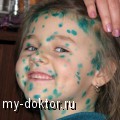 : ,   - MY-DOKTOR.RU