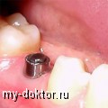    - MY-DOKTOR.RU