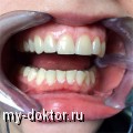 Врач стоматолог отвечает на Ваши вопросы - MY-DOKTOR.RU