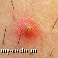    .        - MY-DOKTOR.RU