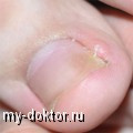    :     ? - MY-DOKTOR.RU