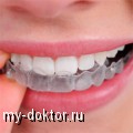    invisalign - MY-DOKTOR.RU