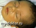   .    - MY-DOKTOR.RU