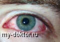 Заболевания глаз - Вопросы окулисту - MY-DOKTOR.RU