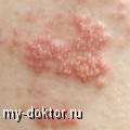      (   ) - MY-DOKTOR.RU